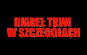 Inwestorze, diabeł tkwi w szczegółach! zobacz dlaczego. część 1